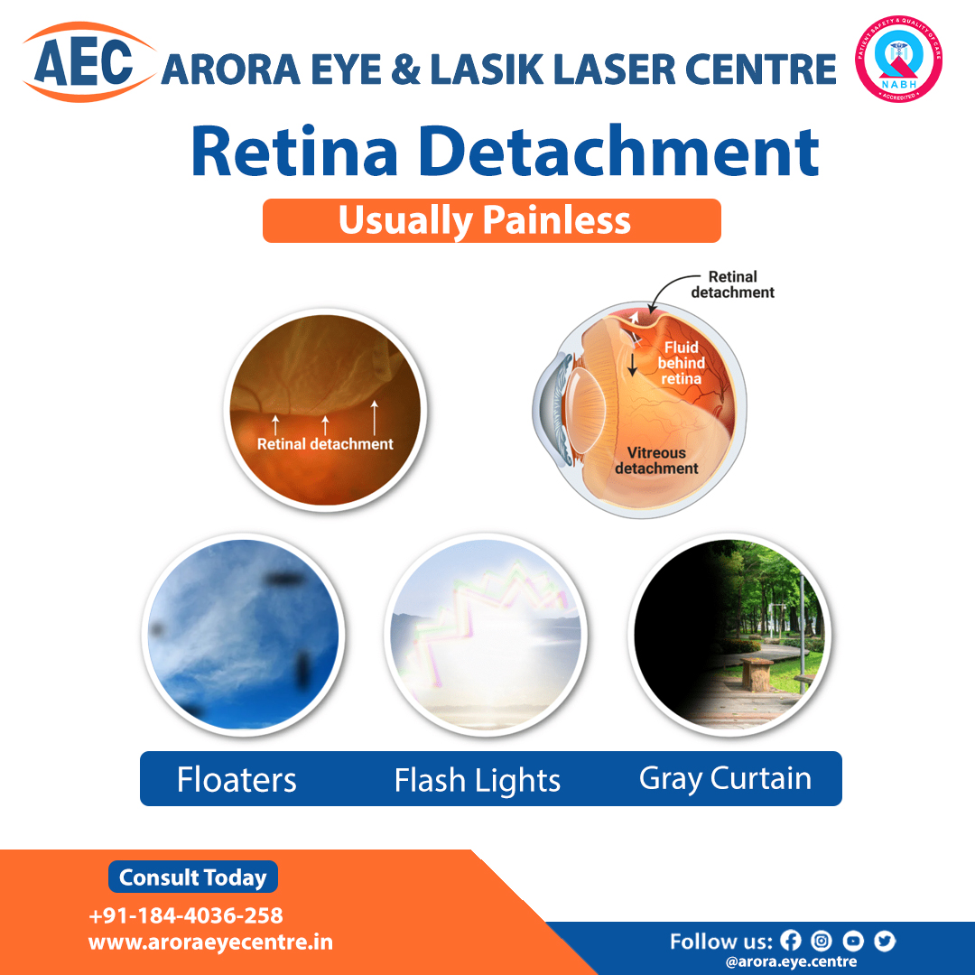 Arora Eye & Lasik Laser Centre: The Best Retina Hospital in Karnal