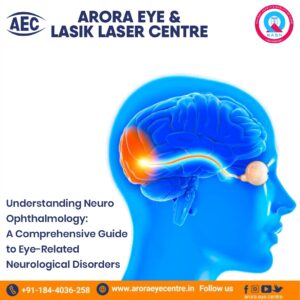 The Best eye hospital in Karnal