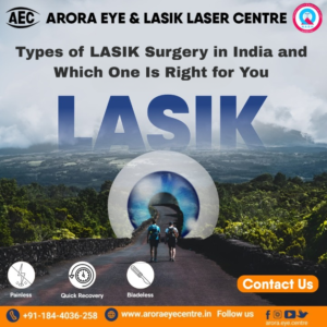 Types of LASIK Surgery in India and Which One Is Right for You